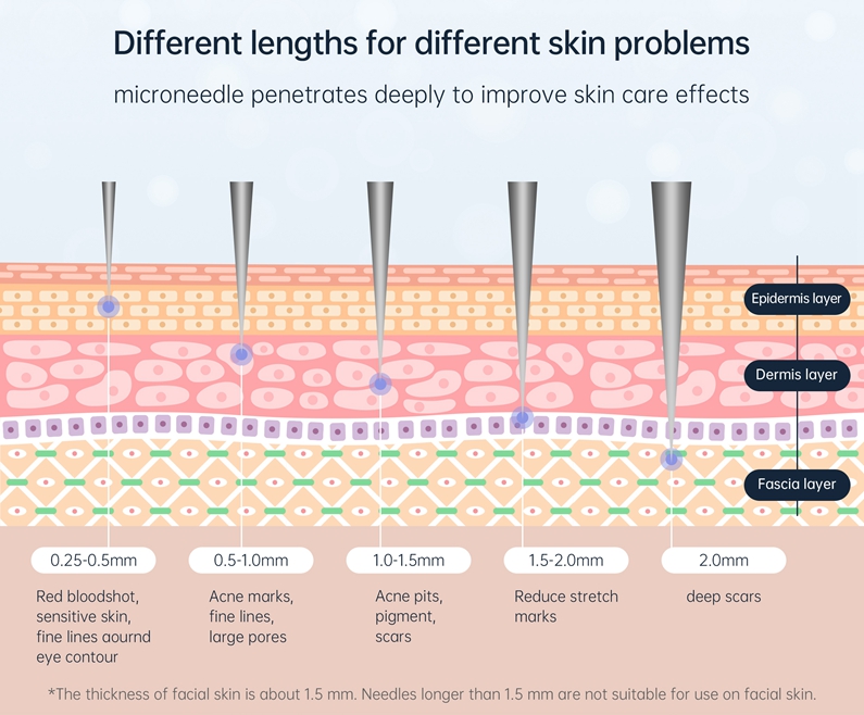 BIO Needle 120-8.jpg